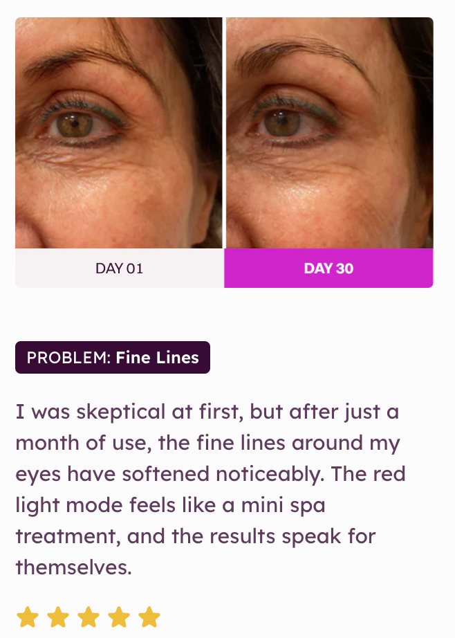 Kendra 7-Color LED Facial Light Therapy Wand